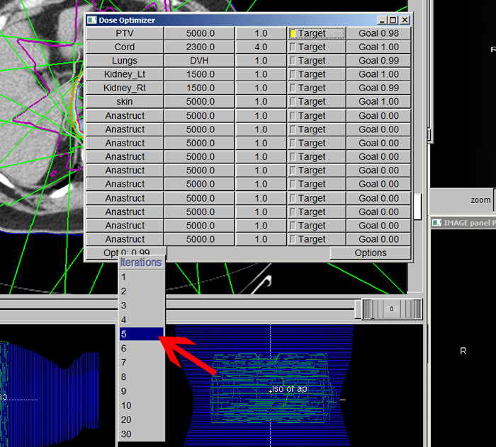 UNC Dosimetry